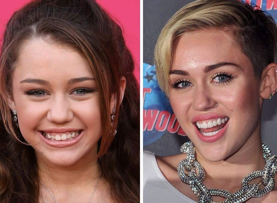 Celebrity Teeth Six Best Dental Before And After Makeovers 5928